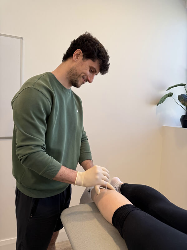 Dry Needling at Balance Twenty One Dry Needling at Balance Twenty One